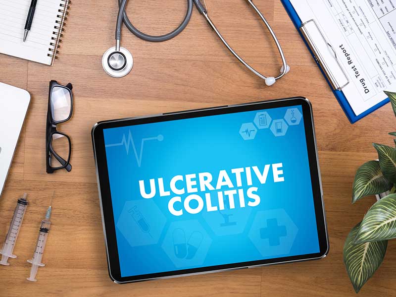 medical-concept-of-ulcerative-colitis-OC-Gastro-Clinic