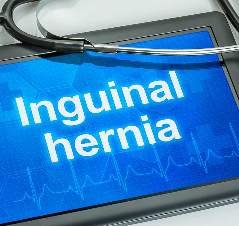 inguinal-hernia-OC-Gastro-Clinic