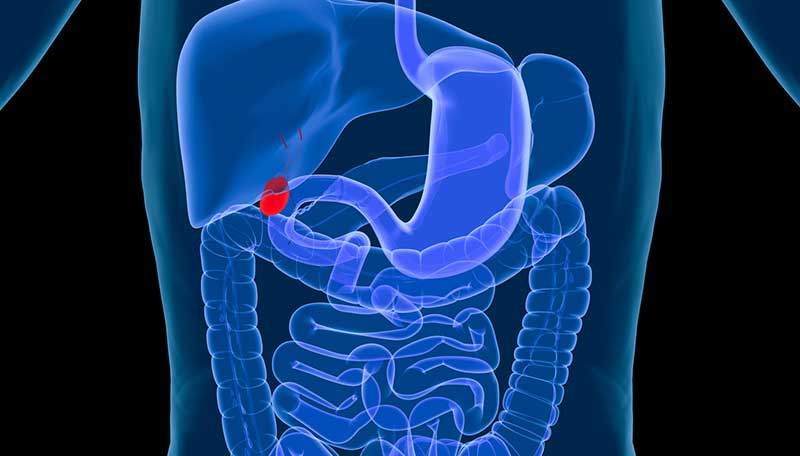 view-of-gall-bladder-Gallbladder-Removal-Orange-County-Gastro