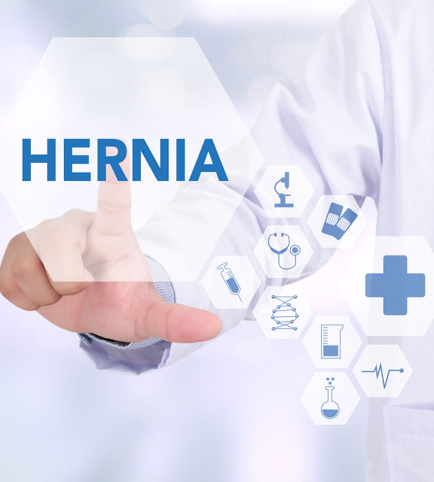 medical-concept-of-hernia-Orange-County-Gastro-Clinic